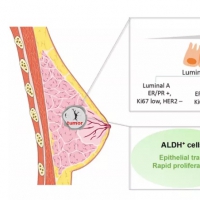 影響因子12.31！中國專家提出乳腺癌腫瘤干細胞治療開拓性研究視角